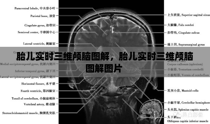 胎儿实时三维颅脑图解，胎儿实时三维颅脑图解图片 