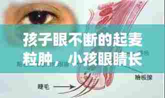 孩子眼不断的起麦粒肿，小孩眼睛长麦粒肿反复复发怎么办 