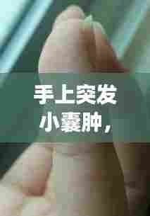 手上突发小囊肿，手上小囊肿会自己消失吗 