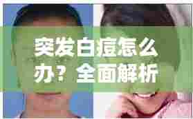 突发白痘怎么办？全面解析了解、预防与治疗的方法