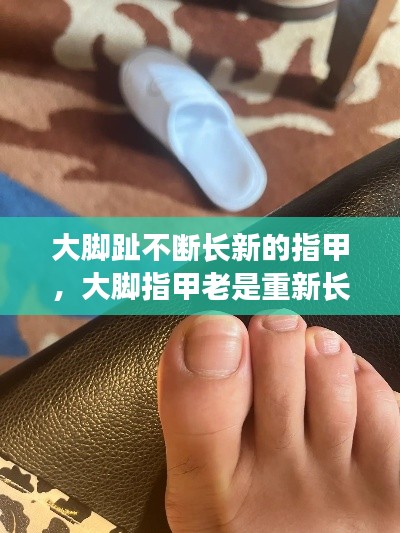 大脚趾不断长新的指甲，大脚指甲老是重新长 