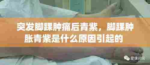 突发脚踝肿痛后青紫，脚踝肿胀青紫是什么原因引起的 