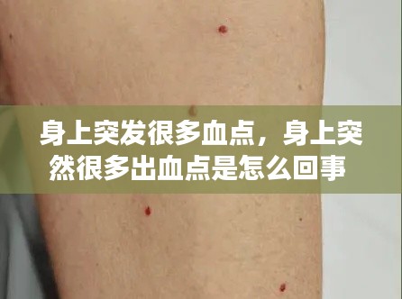 身上突发很多血点，身上突然很多出血点是怎么回事 