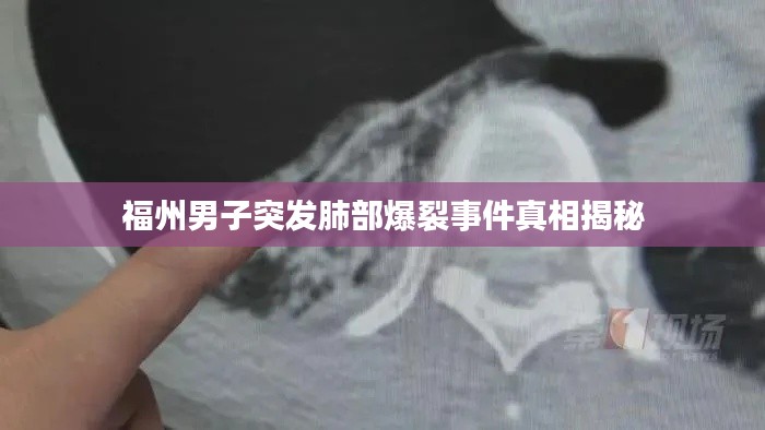 福州男子突发肺部爆裂事件真相揭秘