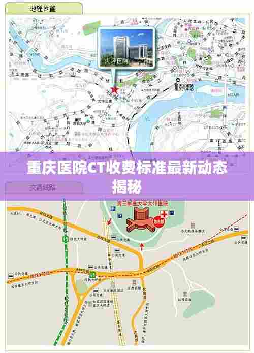 重庆医院CT收费标准最新动态揭秘