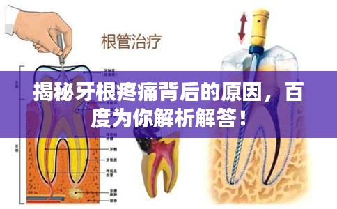 揭秘牙根疼痛背后的原因，百度为你解析解答！