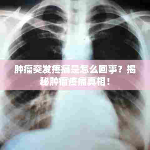 肿瘤突发疼痛是怎么回事？揭秘肿瘤疼痛真相！