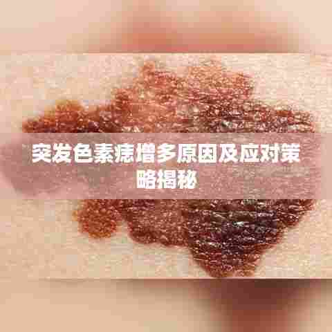 突发色素痣增多原因及应对策略揭秘