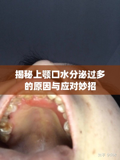 揭秘上颚口水分泌过多的原因与应对妙招