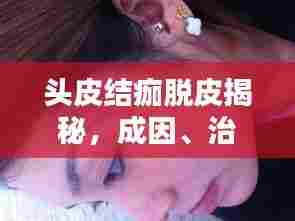 头皮结痂脱皮揭秘，成因、治疗方法与日常护理全攻略